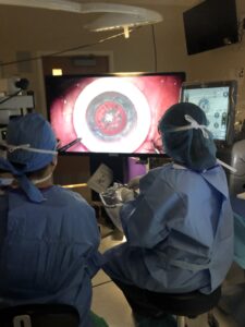 Cataract Surgery in Buffalo, NY. 