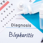 blepharitis treatment buffalo